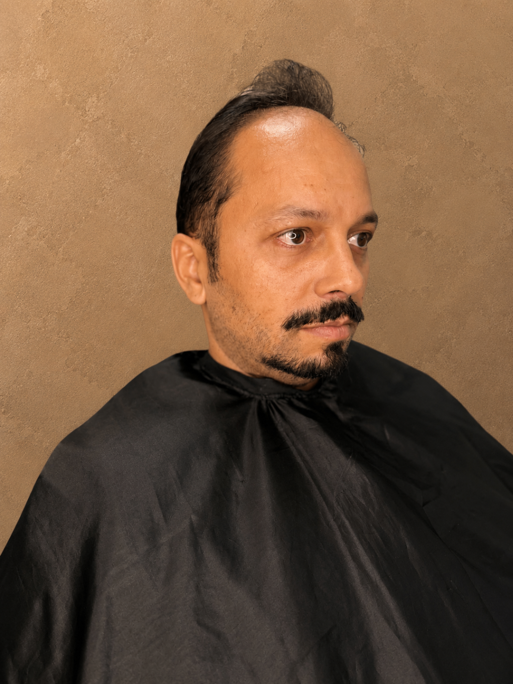 Cliente antes da prótese capilar, com falhas visíveis e expressão séria em perfil.